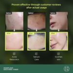 تونر تسکین دهنده آنوا - Image 2