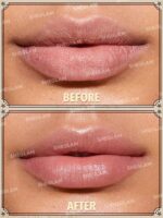 ماسک لب جادویی شیگلم مدل هری پاتر SHEGLAM Harry Potter Magic Cauldron Lip Mask - Image 2