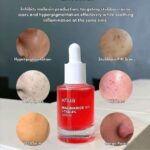 سرم ضد لک نياسيناميد ۱۰% + ترانگزامیک اسيد ۴% آنوا Anua Niacinamide 10% + TXA 4% Dark Spot Correcting Serum - Image 2